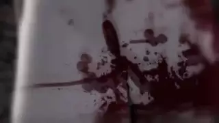 توسع البطن مفلس – إصلاح التضخم السوبر